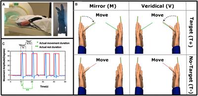 Parietal Activation Associated With Target-Directed Right Hand Movement Is Lateralized by Mirror Feedback to the Ipsilateral Hemisphere